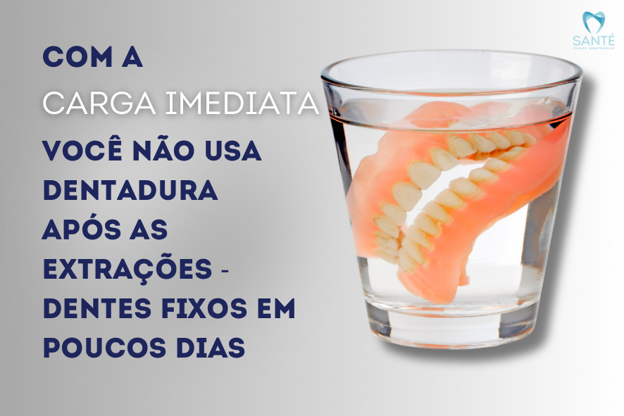 Tirar todos os dentes de uma vez ao mesmo tempo - carga imediata