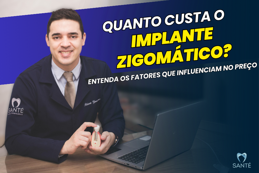 Valor do Implante Zigomático