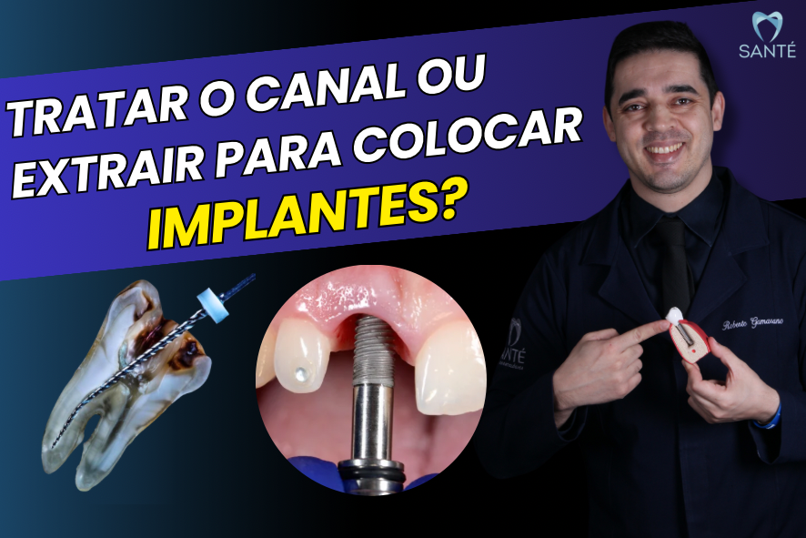 Canal ou implante dentário