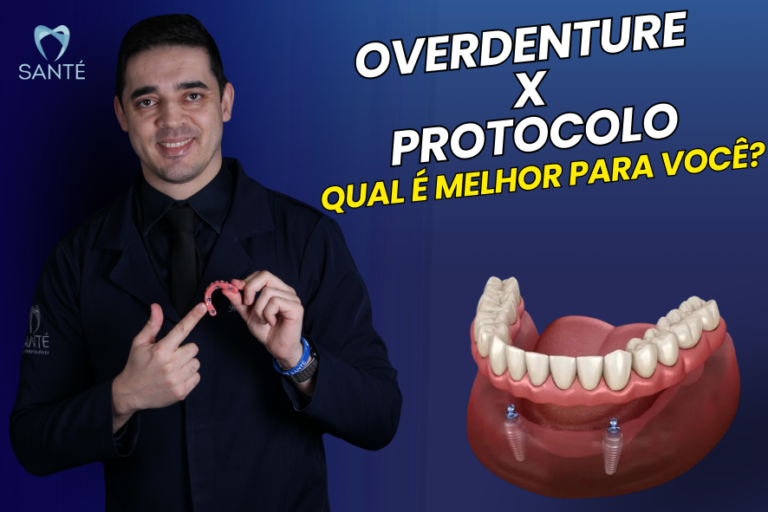 Dentadura de encaixe overdenture