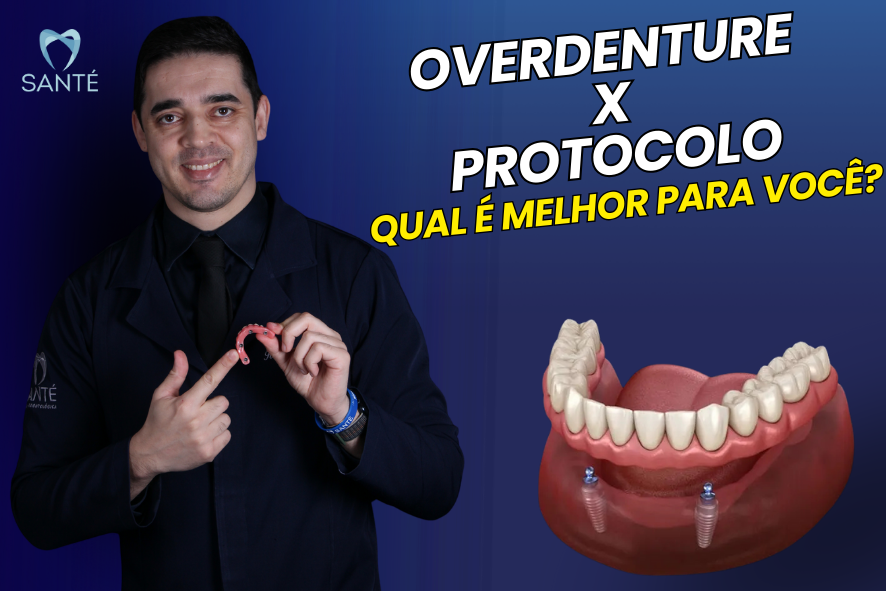 Dentadura de encaixe overdenture