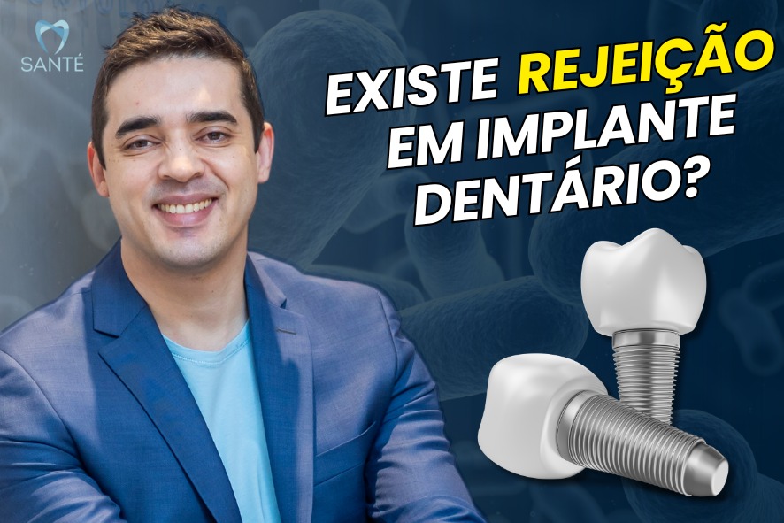 Rejeição implante dentário perda óssea implante