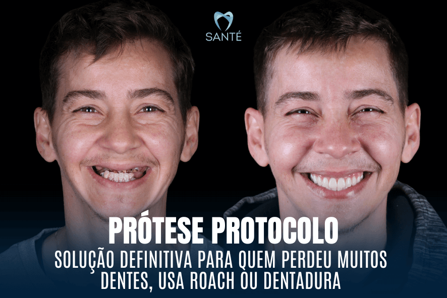 protese protocolo belo horizonte bh