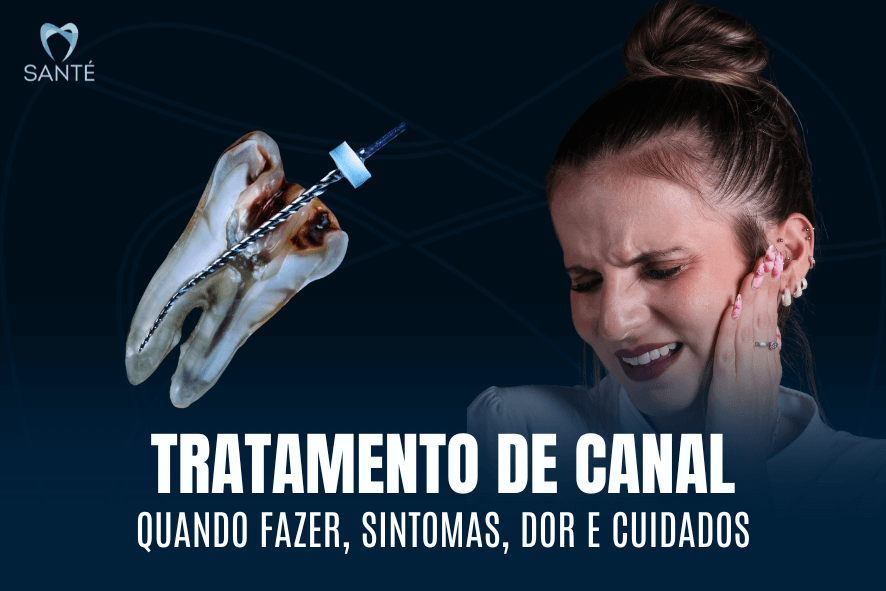 tratamento de canal Belo Horizonte bh