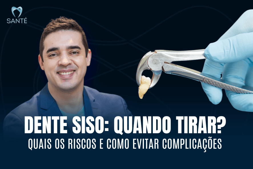 extracao dente siso em belo horizonte bh
