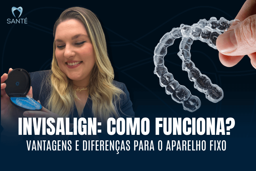 invisalign belo horizonte