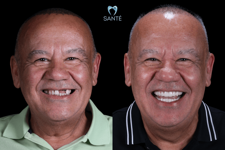 o que e reabilitacao oral