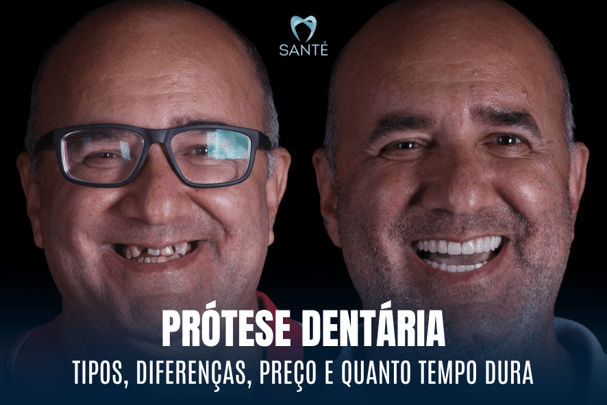 protese fixa em belo horizonte bh