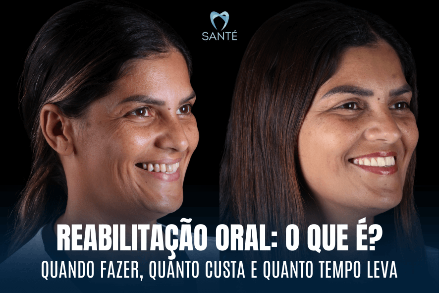 reabilitacao oral belo horizonte bh