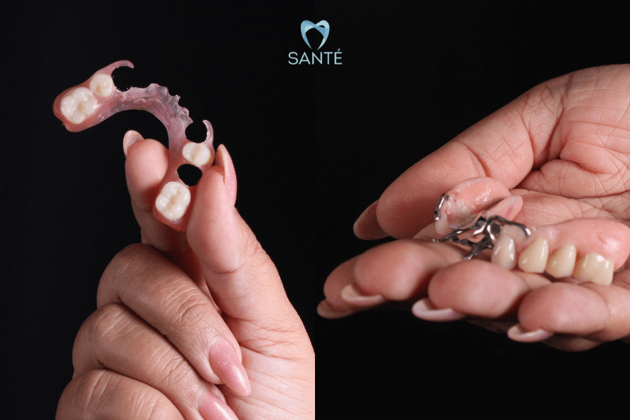 roach e flexite em belo horizonte bh