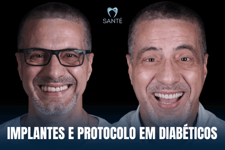 Implante dentário diabetes
