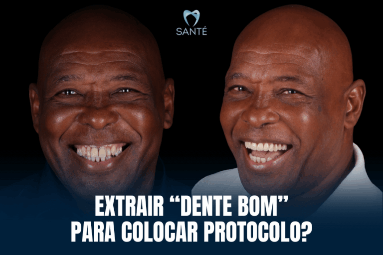 Prótese protocolo antes e depois