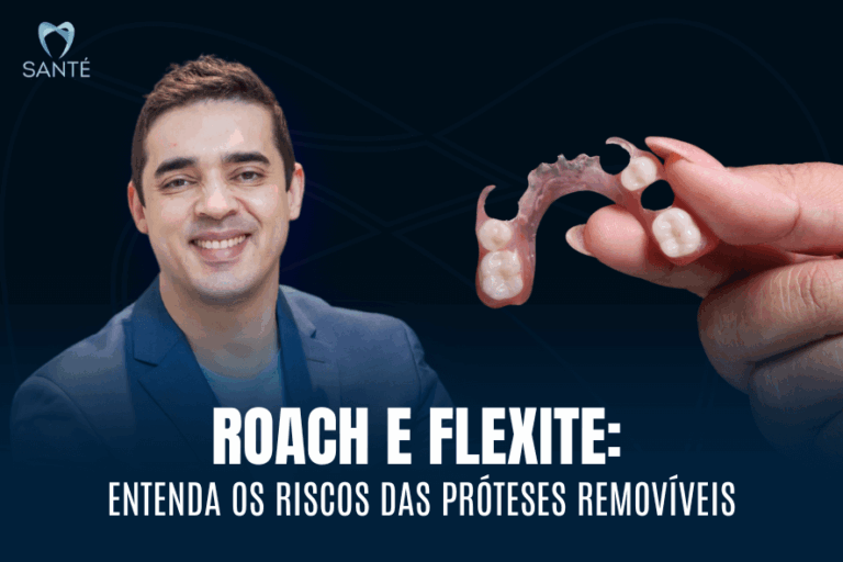 Roach e flexite em BH
