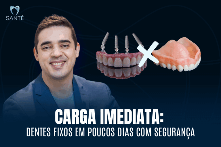 Carga imediata em BH