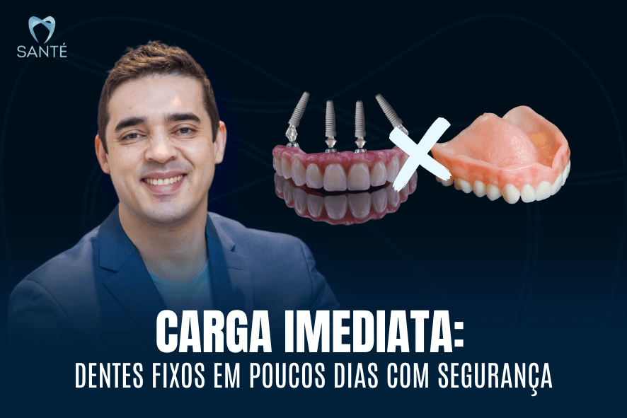 Carga imediata em BH