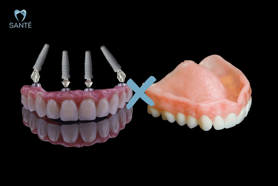 dentadura superior belo horizonte bh