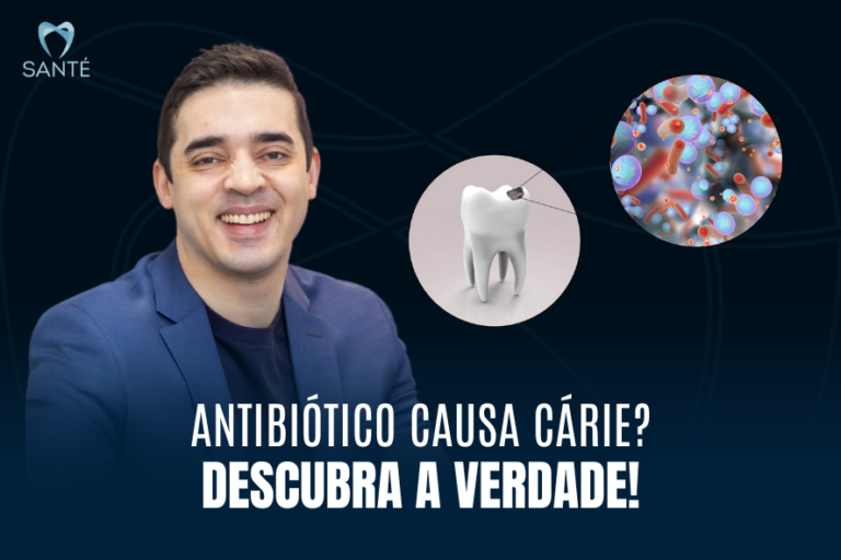 Cárie dentária Belo Horizonte BH