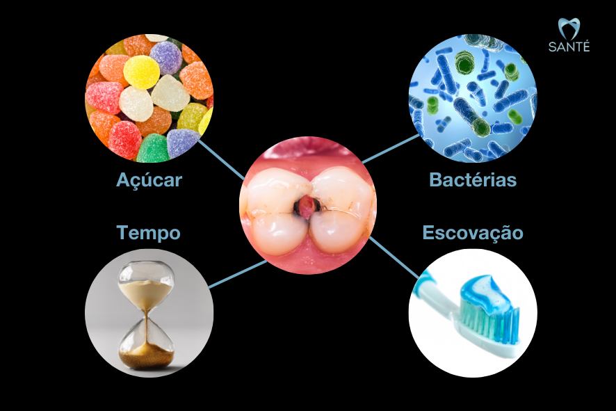 Como evitar a cárie Belo Horizonte