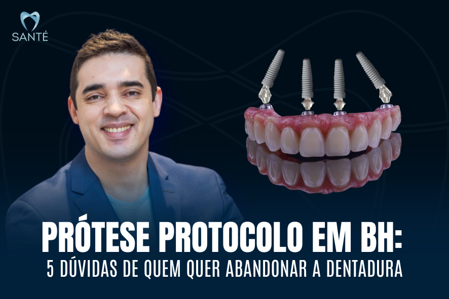 5 Dúvidas Comuns: Prótese Protocolo e Carga Imediata.