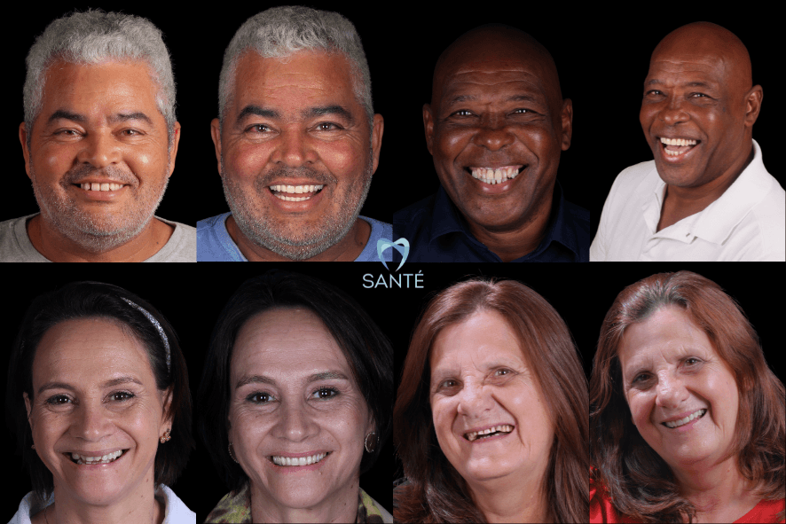 Galeria de antes e depois de homens e mulheres que realizaram prótese protocolo em Belo Horizonte na Clínica Santé, recuperando o sorriso.