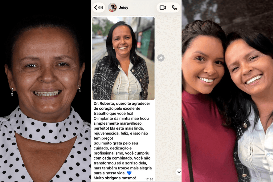 Depoimento de paciente da Clínica Santé em BH sobre prótese protocolo, mostrando fotos de antes e depois e mensagem de agradecimento ao Dr. Roberto.