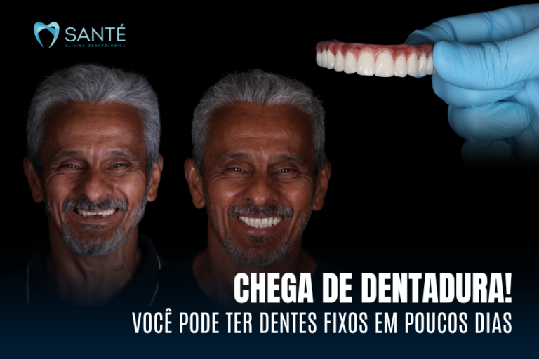 Paciente sorrindo após trocar dentadura por dentes fixos em BH. Texto na imagem: Chega de dentadura! Você pode ter dentes fixos em poucos dias.