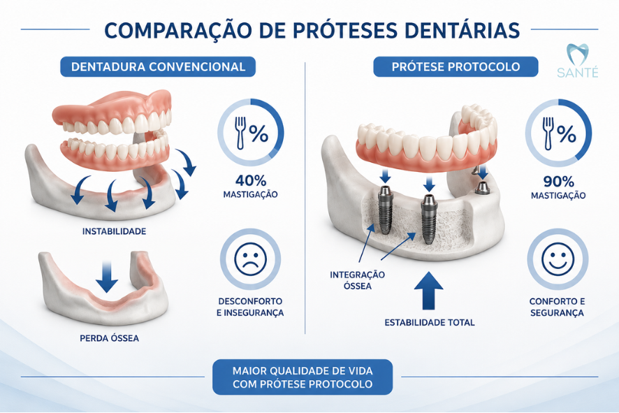 Diagrama explicativo mostrando os benefícios na mastigação e estabilidade da prótese protocolo em Belo Horizonte na Santé