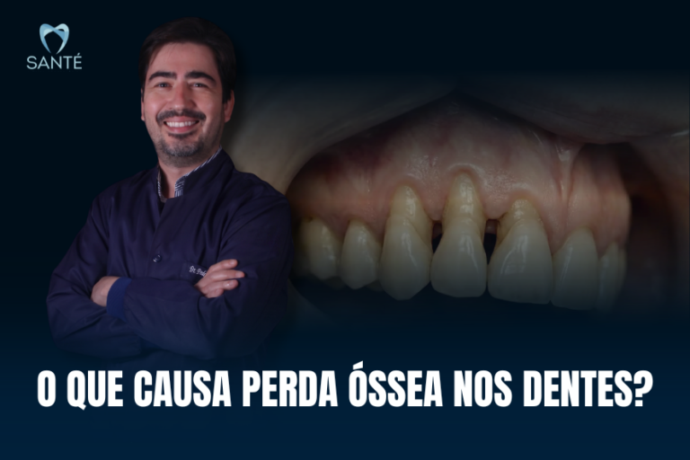 Banner sobre tratamento de perda óssea em BH com dentista da Clínica Santé e a pergunta explicativa o que causa perda óssea nos dentes.