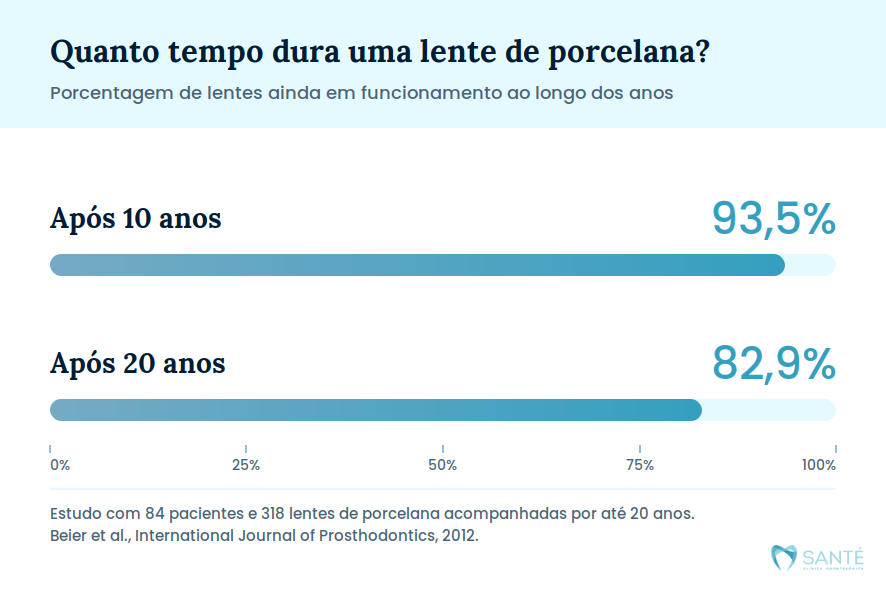durabilidade da faceta e lentes de contato dentais em bh