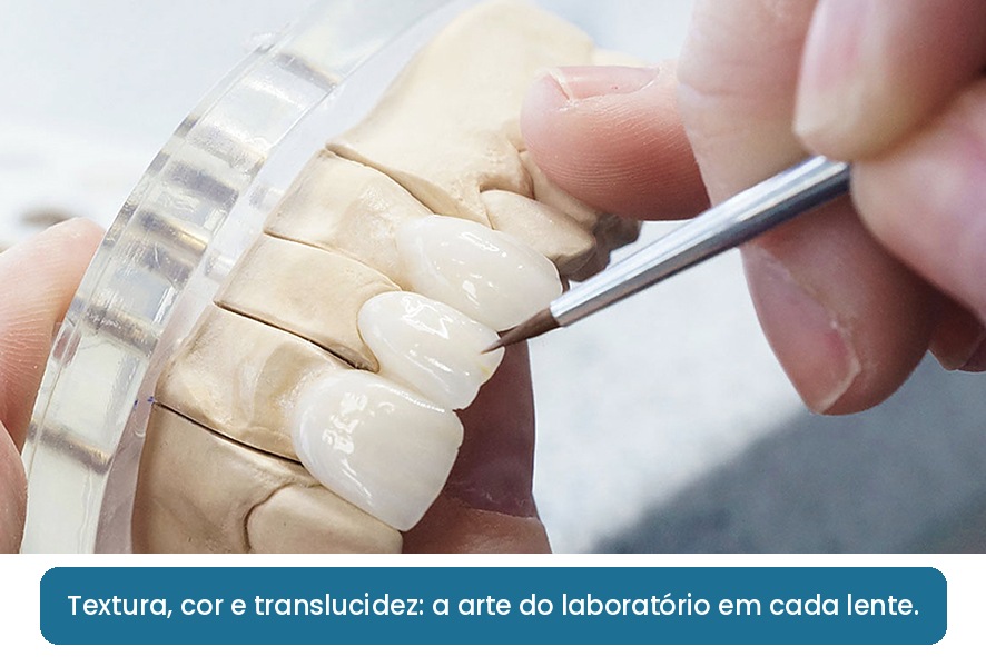 laboratório de lentes de porcelana