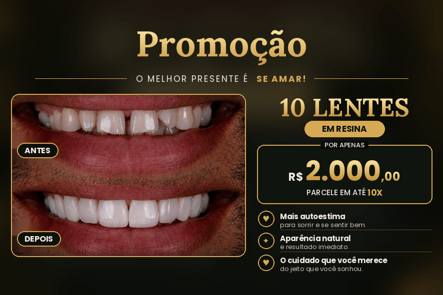lentes nos dentes preco em bh