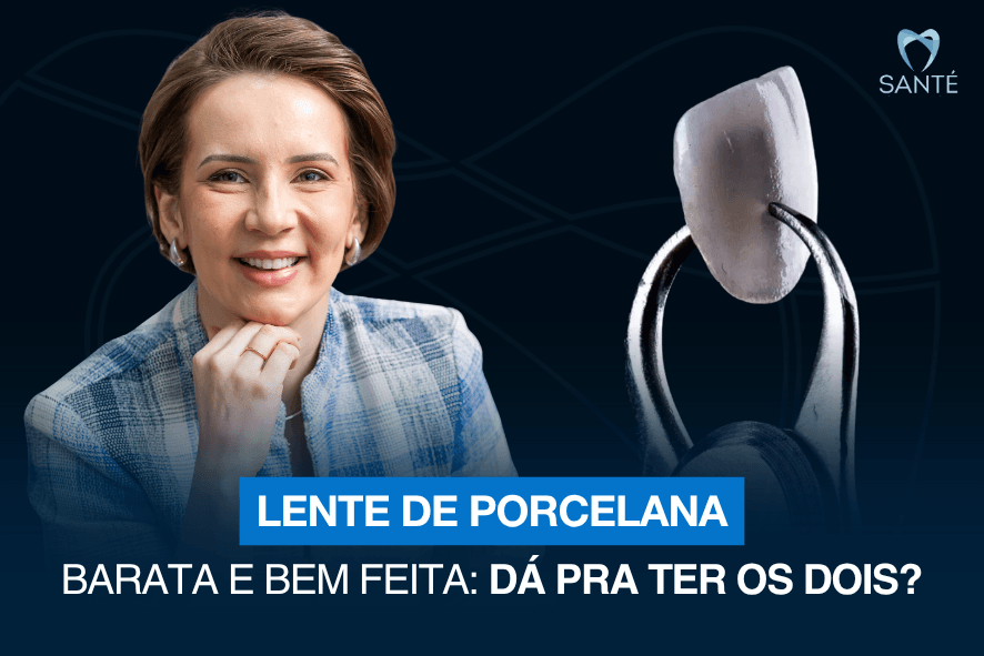 quanto custa o preco da lente de porcelana em bh belo horizonte